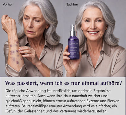 ZARTDERM® Feuchtigkeitsspray – Intensive Feuchtigkeit für reife, empfindliche Haut – 60 ml