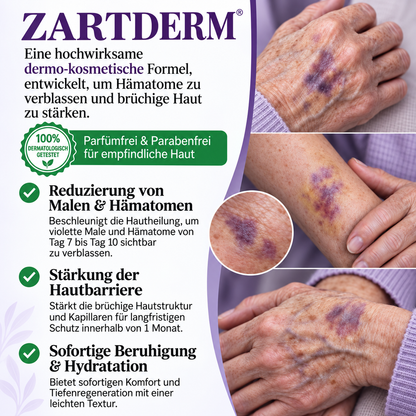 ZARTDERM® Spray gegen blaue Flecken – für empfindliche, dünne Haut