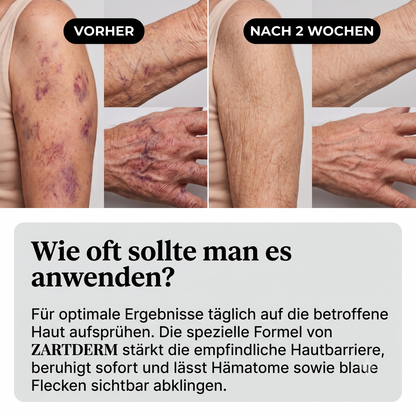 ZARTDERM® Feuchtigkeitsspray – Intensive Feuchtigkeit für reife, empfindliche Haut – 60 ml